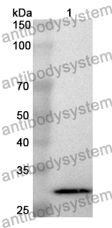 Anti-DPYD Polyclonal Antibody