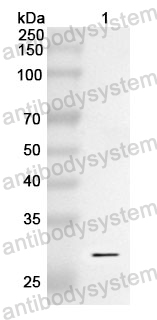 Anti-FAP Polyclonal Antibody