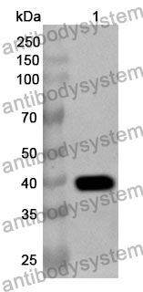 Anti-TP53BP1 Polyclonal Antibody