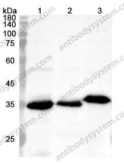 Anti-AIMP1 Polyclonal Antibody