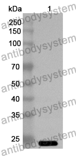 Anti-ILF3 Polyclonal Antibody