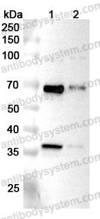 Anti-LMAN2 Polyclonal Antibody