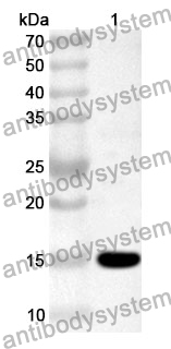 Anti-CD161/KLRB1 Polyclonal Antibody