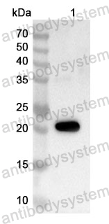 Anti-Human FOXC1 Polyclonal Antibody