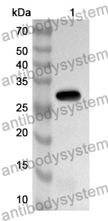 Anti-Human NFATC3 Polyclonal Antibody