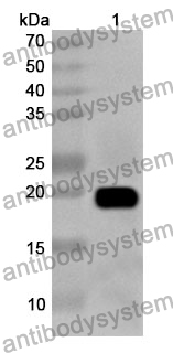 Anti-HSPB3 Polyclonal Antibody