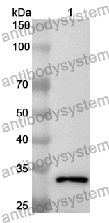 Anti-GRIK2 Polyclonal Antibody