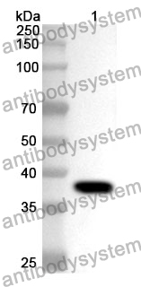 Anti-ECH1 Polyclonal Antibody