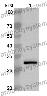 Anti-Human ARHGAP5 Polyclonal Antibody