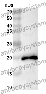 Anti-CDC16 Polyclonal Antibody