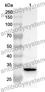 Anti-COASY Polyclonal Antibody