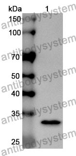 Anti-Human IFT88 Polyclonal Antibody