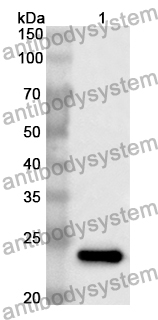 Anti-Human SPP2 Polyclonal Antibody