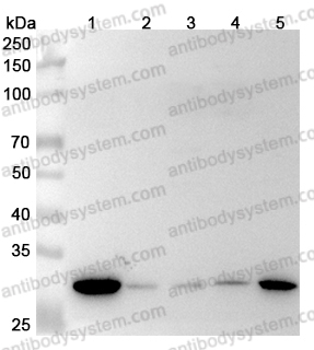 Anti-Human MTAP Polyclonal Antibody