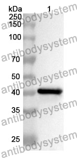 Anti-NR1H3 Polyclonal Antibody