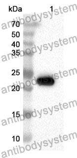 Anti-Human AIMP2 Polyclonal Antibody