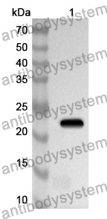 Anti-CBX3 Polyclonal Antibody