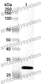 Anti-PSMD2 Polyclonal Antibody