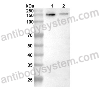 Anti-GRIN2B Polyclonal Antibody