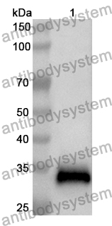 Anti-Human CHIT1 Polyclonal Antibody