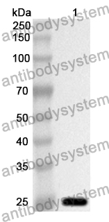 Anti-MAP3K1 Polyclonal Antibody