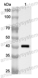 Anti-Human PRKG2 Polyclonal Antibody