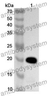 Anti-CD94/KLRD1 Polyclonal Antibody