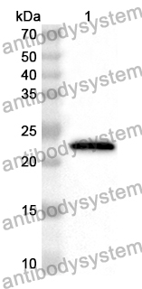 Anti-Human SRSF9 Polyclonal Antibody