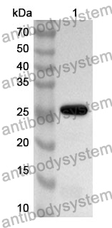 Anti-PTK7 Polyclonal Antibody