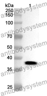 Anti-SKP2 Polyclonal Antibody