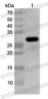 Anti-Human SGCG Polyclonal Antibody