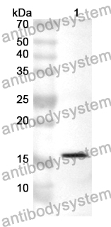 Anti-Human CD11d/ITGAD Polyclonal Antibody