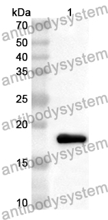 Anti-Human MFAP5 Polyclonal Antibody