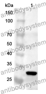 Anti-CTBP1 Polyclonal Antibody