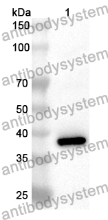 Anti-CTBP1 Polyclonal Antibody