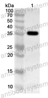 Anti-Human MYO7A Polyclonal Antibody