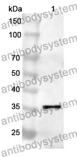 Anti-Human MRPL49 Polyclonal Antibody