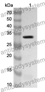 Anti-ILK Polyclonal Antibody