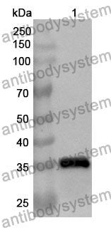 Anti-MSLN Polyclonal Antibody