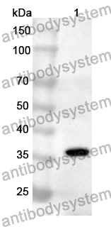 Anti-Human TCOF1 Polyclonal Antibody