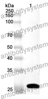 Anti-SLC39A6 Polyclonal Antibody