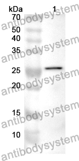 Anti-ADAM15/MDC15 Polyclonal Antibody