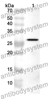 Anti-FKBP5 Polyclonal Antibody