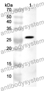 Anti-Human MYO9B Polyclonal Antibody