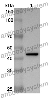 Anti-Human ROCK1 Polyclonal Antibody