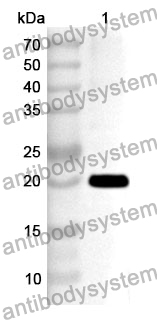 Anti-Human NFATC2 Polyclonal Antibody