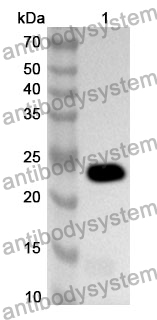 Anti-SMAD4 Polyclonal Antibody