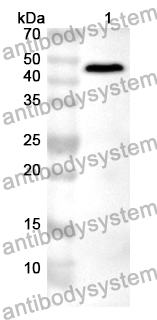 Anti-Human TCIRG1 Polyclonal Antibody