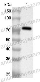 Anti-BIRC2 Polyclonal Antibody