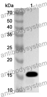 Anti-SQSTM1/p62 Polyclonal Antibody